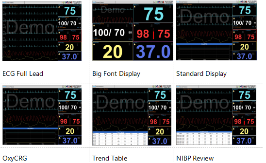 patient vitals monitor, portable patient monitor