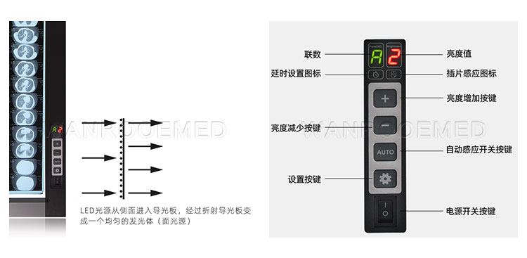 led x ray illuminator,x ray display,negatoscope led,x ray illuminator price,led view box