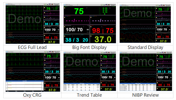 vet monitor,monitor multiparameter,life monitor machine,veterinary patient monitor,hospital monitor