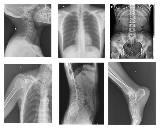 radiography equipment,digital imaging equipment,dr imaging,fluoroscopy equipment