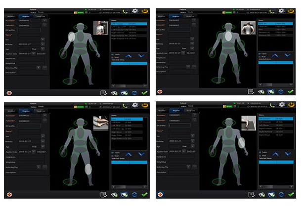 radiography equipment,digital imaging equipment,dr imaging,fluoroscopy equipment