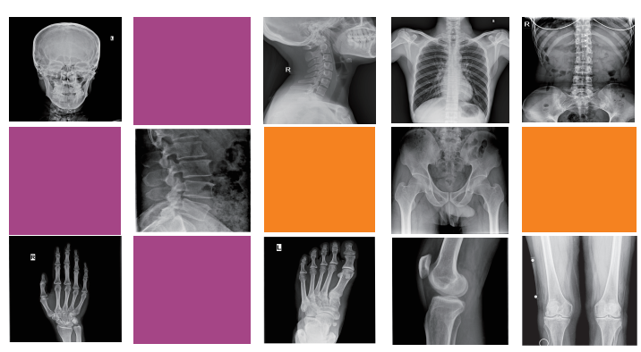 dr fluoroscopy, radiology systems, dr radiography system 