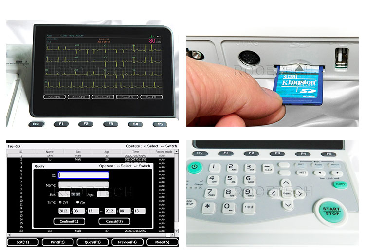 ecg machine with interpretation, resting ecg machine, 3 channel ecg machine