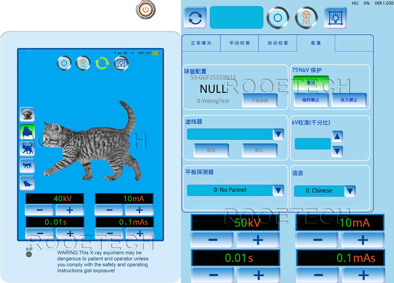 digital x-ray machine, abdominal x ray, chest x ray 