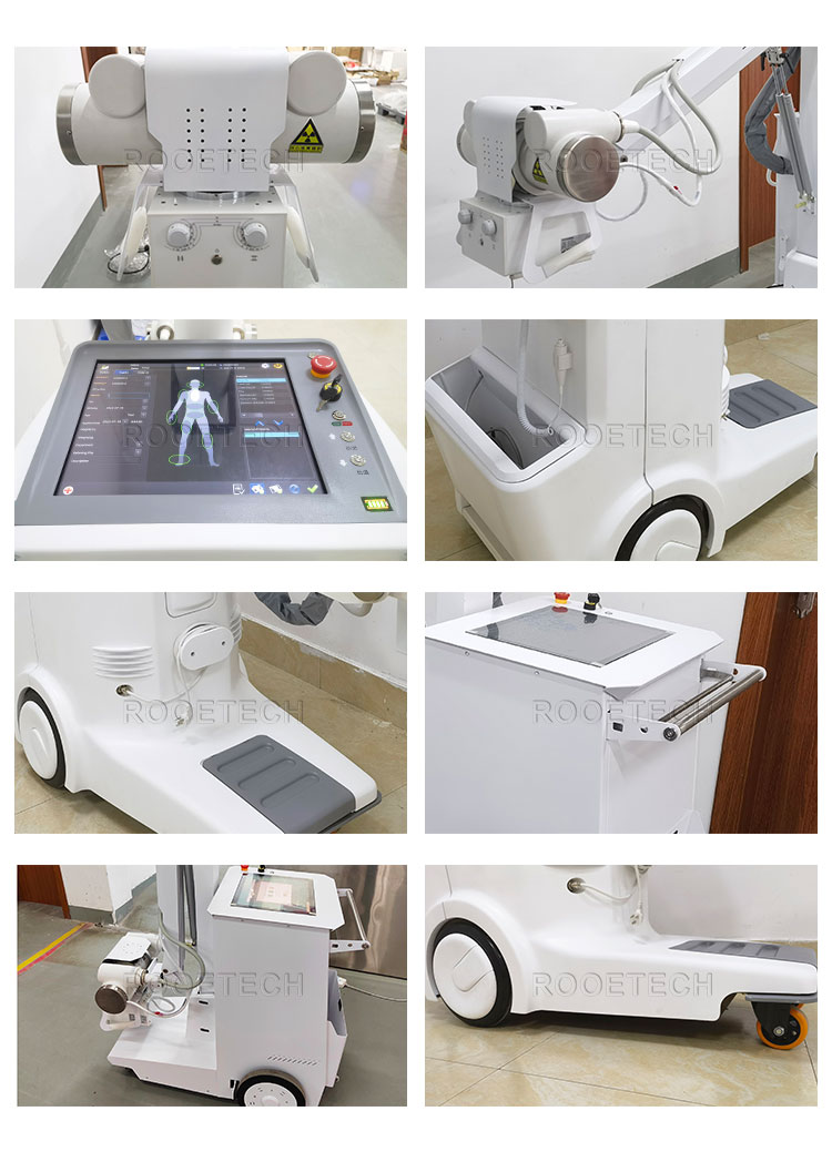 analogic x ray machine,radiography machine,radiography machine,medical diagnostic equipment