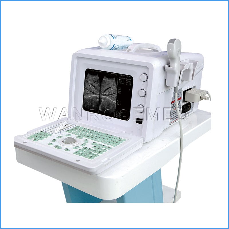 Scanner d'ultrason de la couleur numérique 4D de US3101A complet