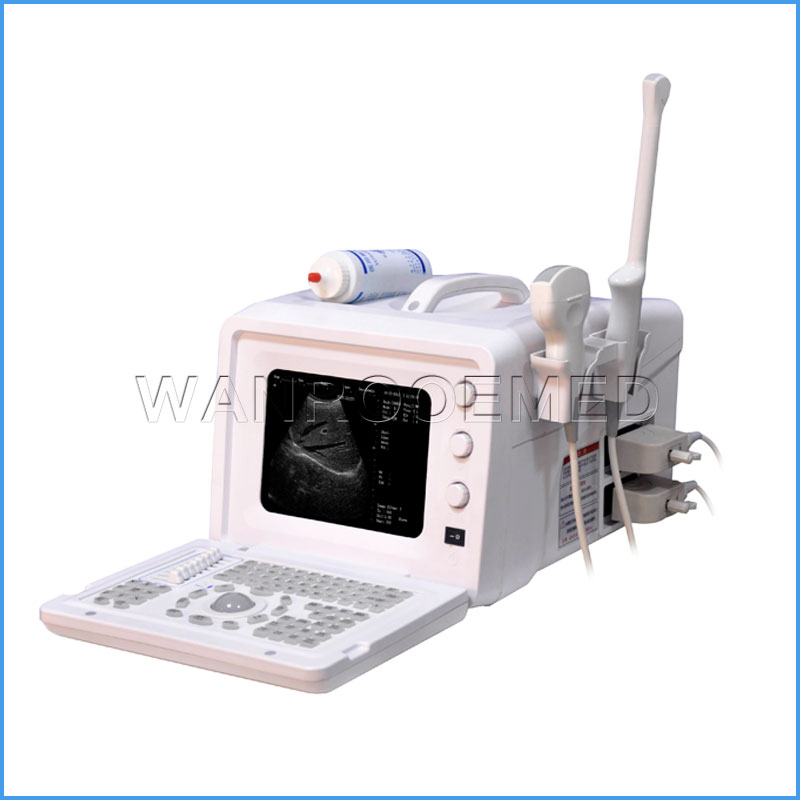 US330 Medical Machine à ultrasons Doppler couleur 3D