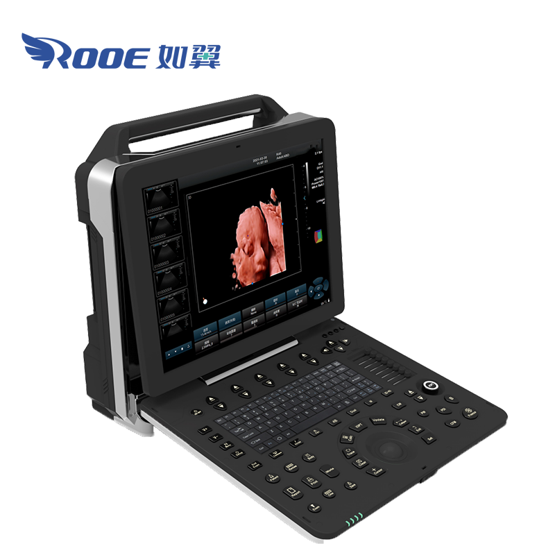 USC300PRO Digital Medical Color Doppler Baby 4D Ultrasound Scan Color Doppler Machine