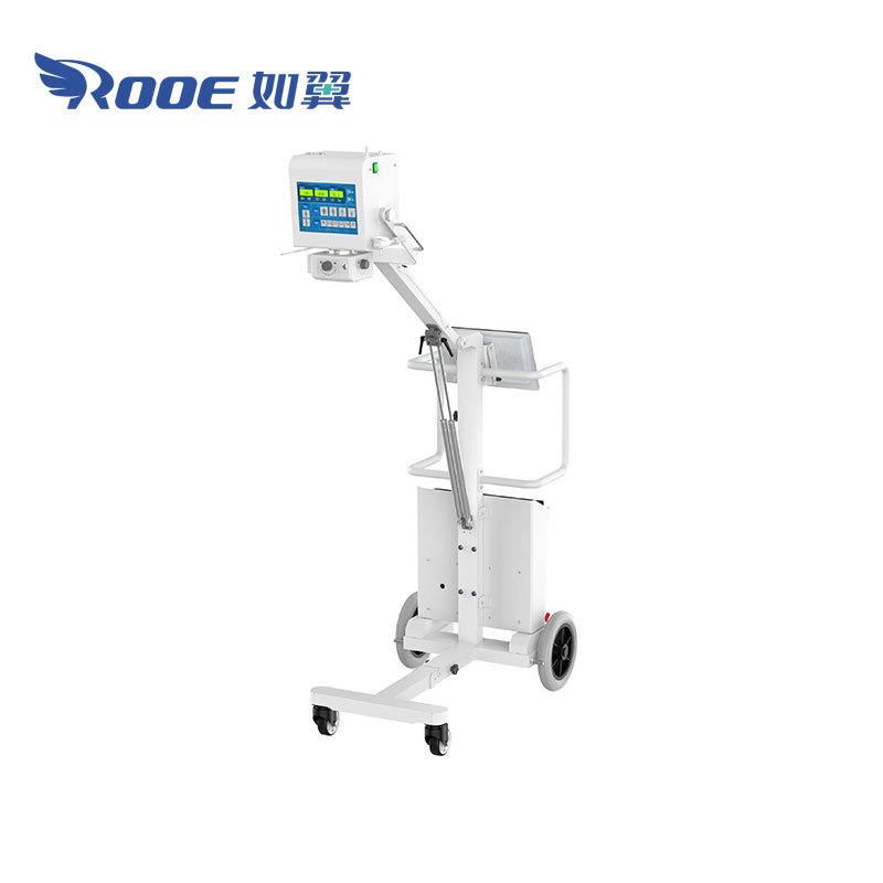 Why choose a portable DR X-ray machine?