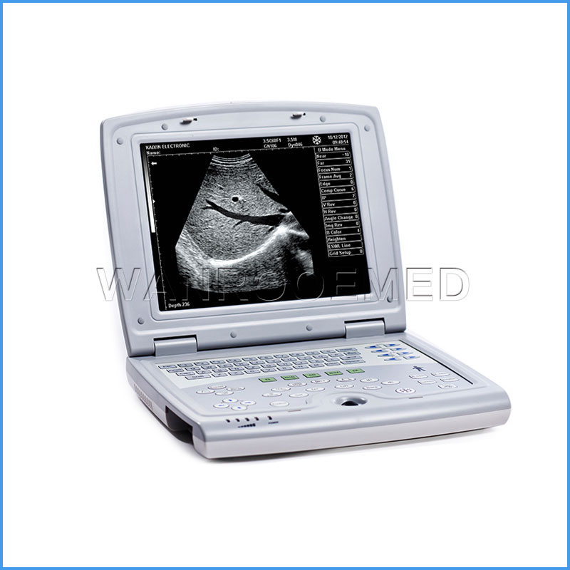 Scanner de machine à ultrasons pour ordinateur portable
