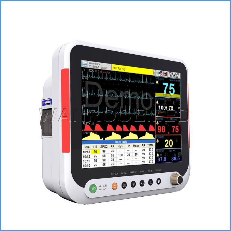 F9 15 pulgadas de monitor de paciente médico multi-parámetro para adultos y pediátricos