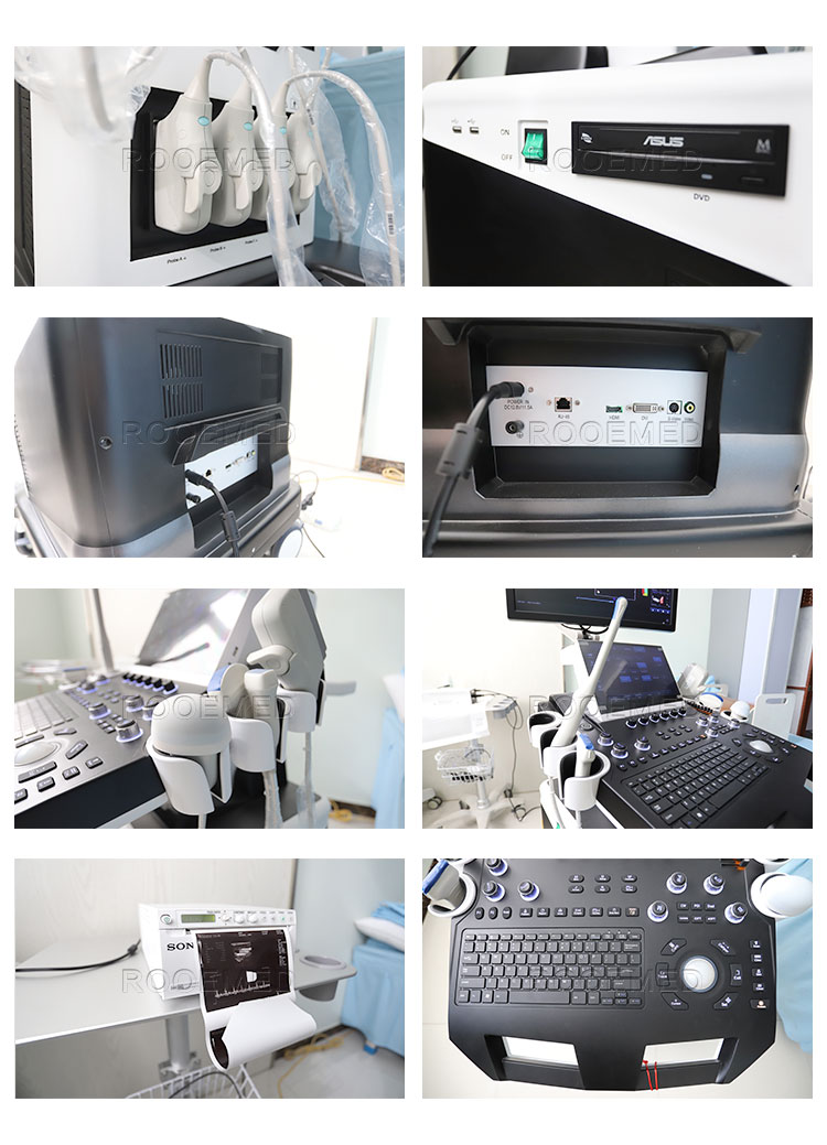 ultrasound machine,5d ultrasound machine,wireless ultrasound probe,baby ultrasound machine,ultrasound scanner