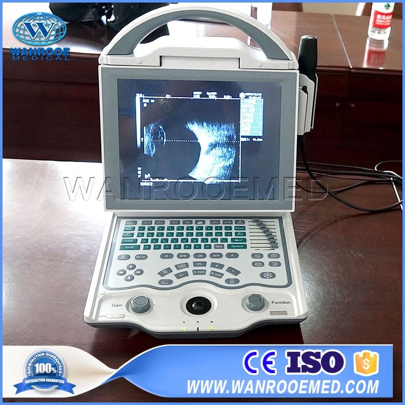 US101 10.4 Inch Notebook Portable Ophthalmic A/B Scan Ultrasound Machine