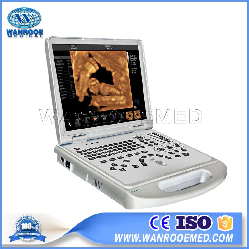USC60 Plus 4D Portable Ultrasonic Diagnostic Ultrasound Scanner with Convex Probe