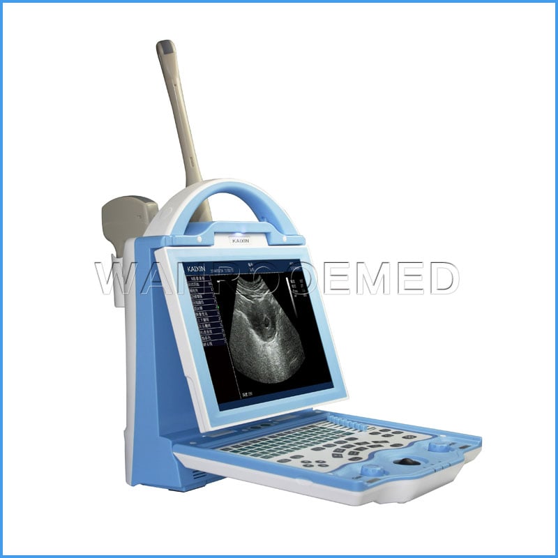 Precio portátil de la máquina del ultrasonido de Doppler del color de USKX5600 médico