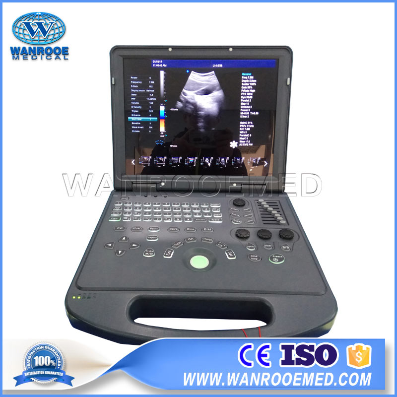 USC60-Color-Doppler-Ultrasound-303.jpg