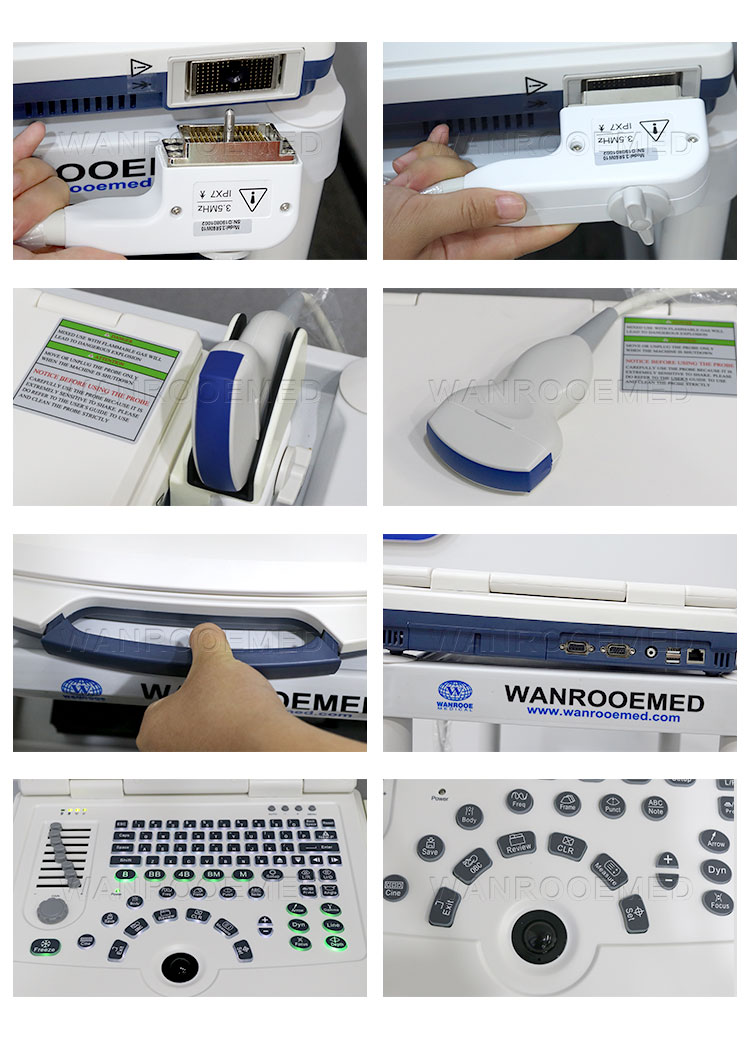 US580  Diagnostic Ultrasound Laptop Ultrasound Scanner For Pregnancy.jpg