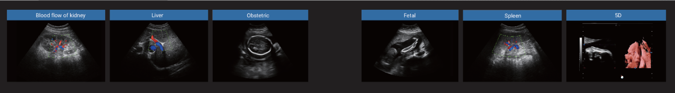 4d ultrasound machine,color doppler ultrasound, baby ultrasound machine,pregnancy ultrasound machine,portable ultrasound therapy machine 