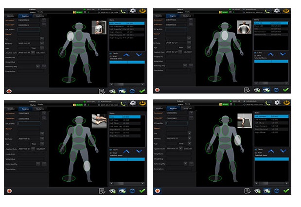 radiography equipment,digital imaging equipment,dr imaging,fluoroscopy equipment radiography equipment,digital imaging equipment,dr imaging,fluoroscopy equipment
