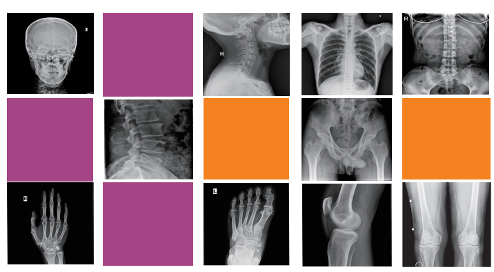 dr fluoroscopy, radiology systems, dr radiography system dr fluoroscopy, radiology systems, dr radiography system