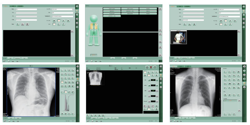 dr fluoroscopy, radiology systems, dr radiography system dr fluoroscopy, radiology systems, dr radiography system