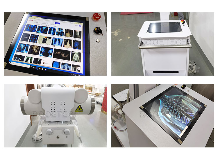 analogic x ray machine,radiography machine,radiography machine,medical diagnostic equipment analogic x ray machine,radiography machine,radiography machine,medical diagnostic equipment