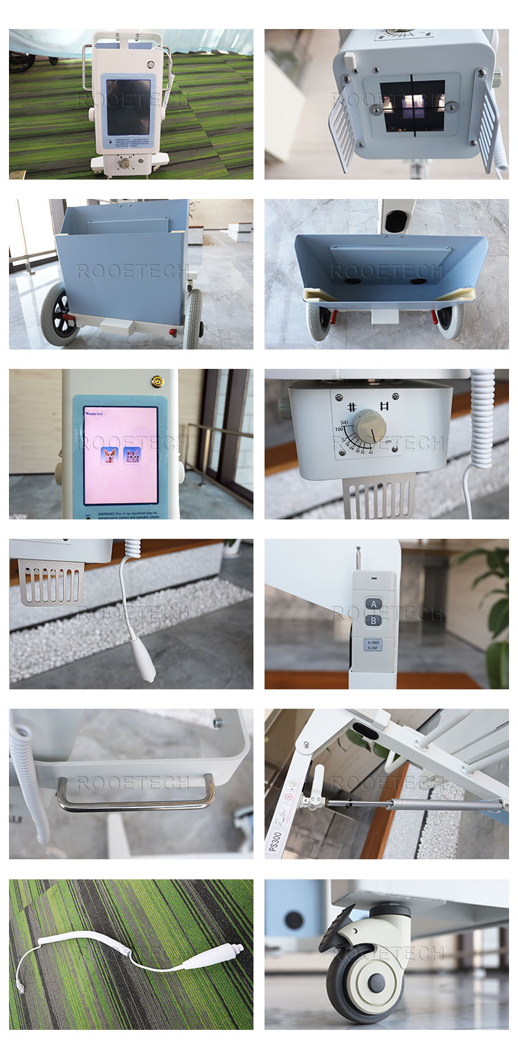 digital x-ray machine, abdominal x ray, chest x ray digital x-ray machine, abdominal x ray, chest x ray