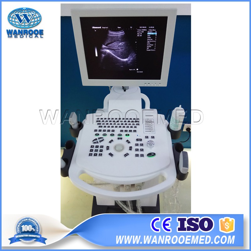 US370 Medical Portable Full-Digital Trolley Pregnancy Fetal Diagnostic Ultrasound Scanner Machine