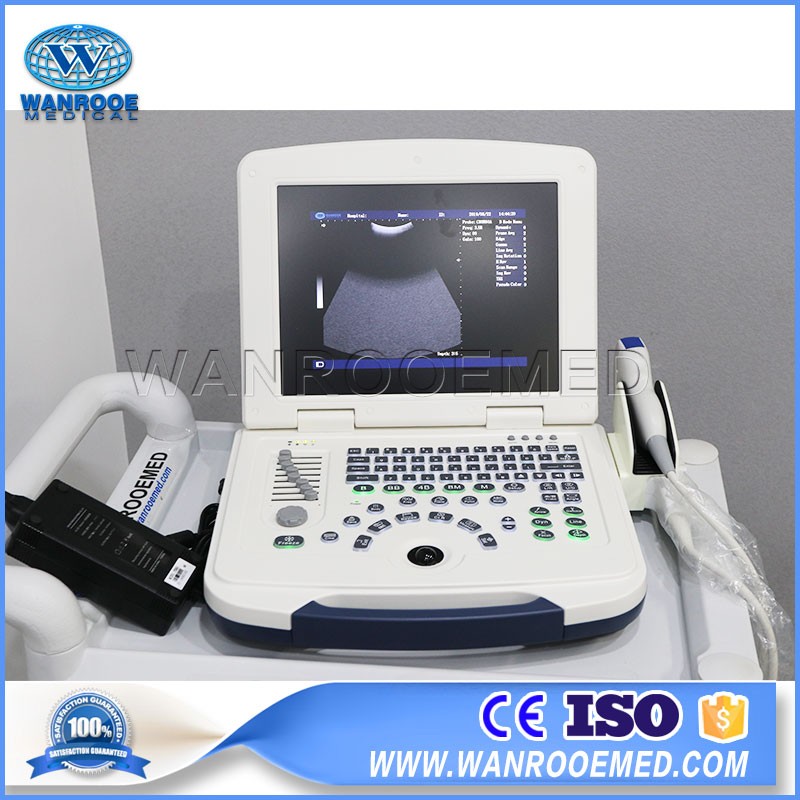 US580 Portable Diagnostic Ultrasound Laptop Ultrasound Scanner For Pregnancy